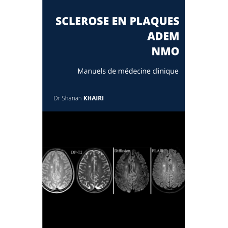 Sclérose en plaques, NMO, ADEM (pdf)